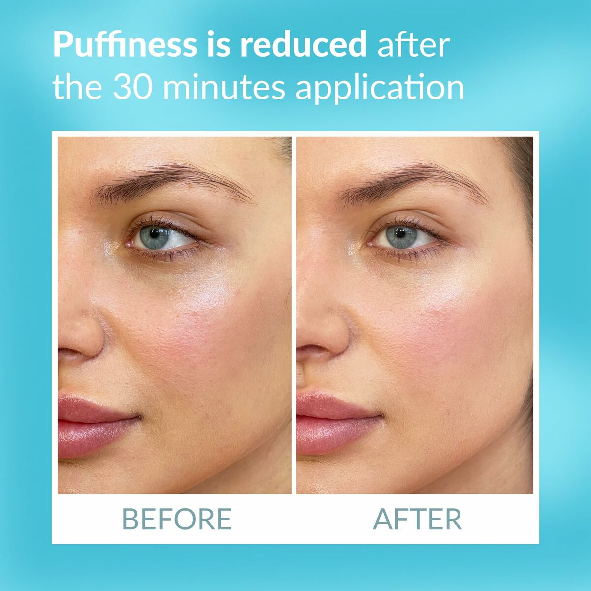 V2HDE50BF1ED3A5D25A7422930BAD13781AR7202267P8